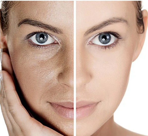 Maskstick Green - Mascarilla de arcilla para poros abiertos, granos y exceso de grasa