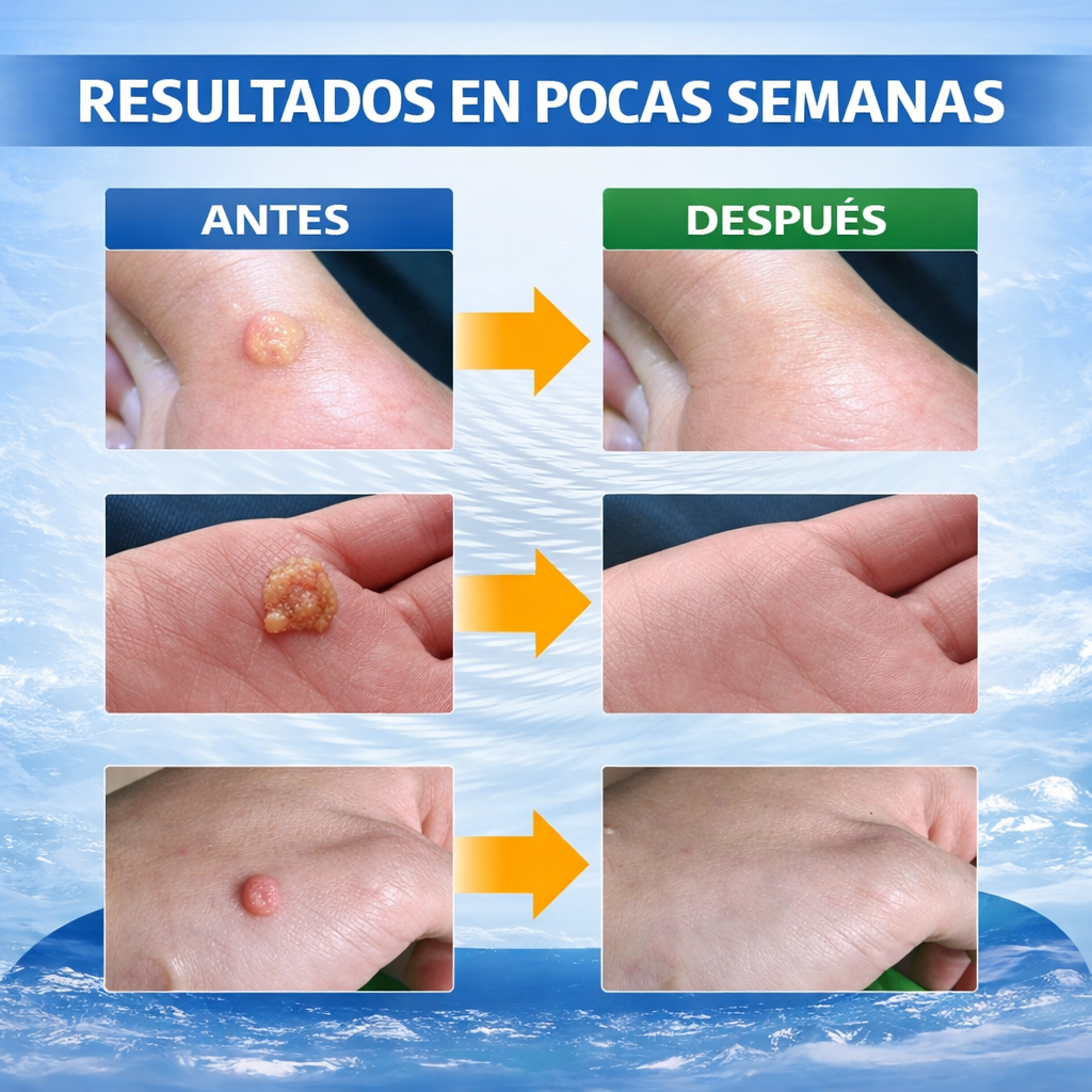 PARCHES SKIN TAG - ELIMINA VERRUGAS SIN DOLOR NI CIRUGÍA